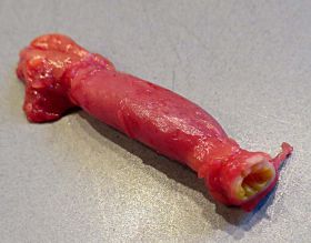 Magen Drüsenmagen 3.jpg