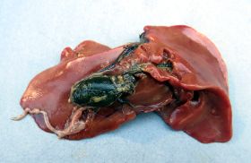 Gallenblase an Organen 2.jpg